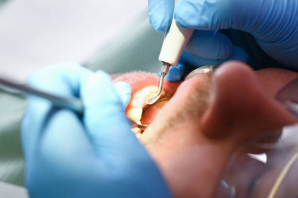 Best Mobile Emergency Dentist in Mansfield, TX