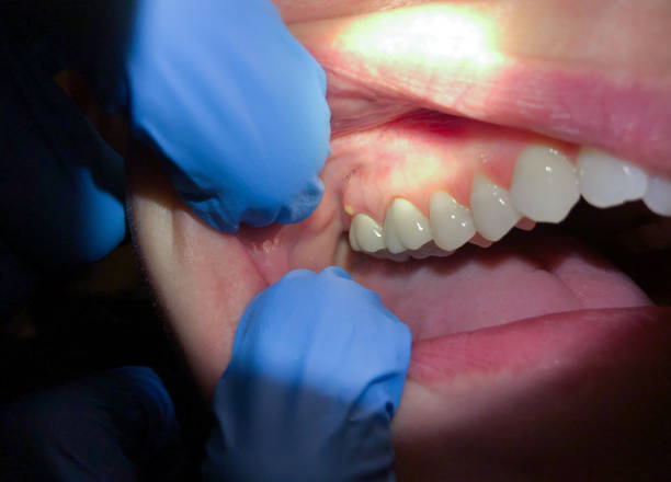 Best Emergency Dentist for Knocked-Out Tooth in Mansfield, TX