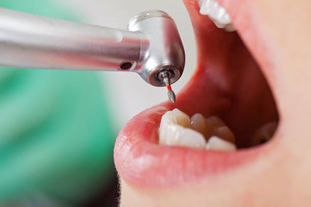 Best Weekend Emergency Dentist in Mansfield, TX